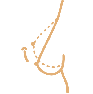 Chirurgia del Seno