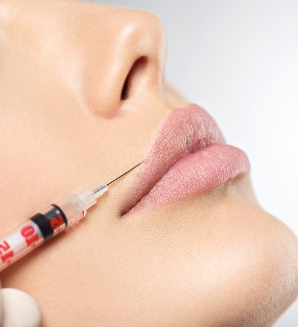 Lipofilling